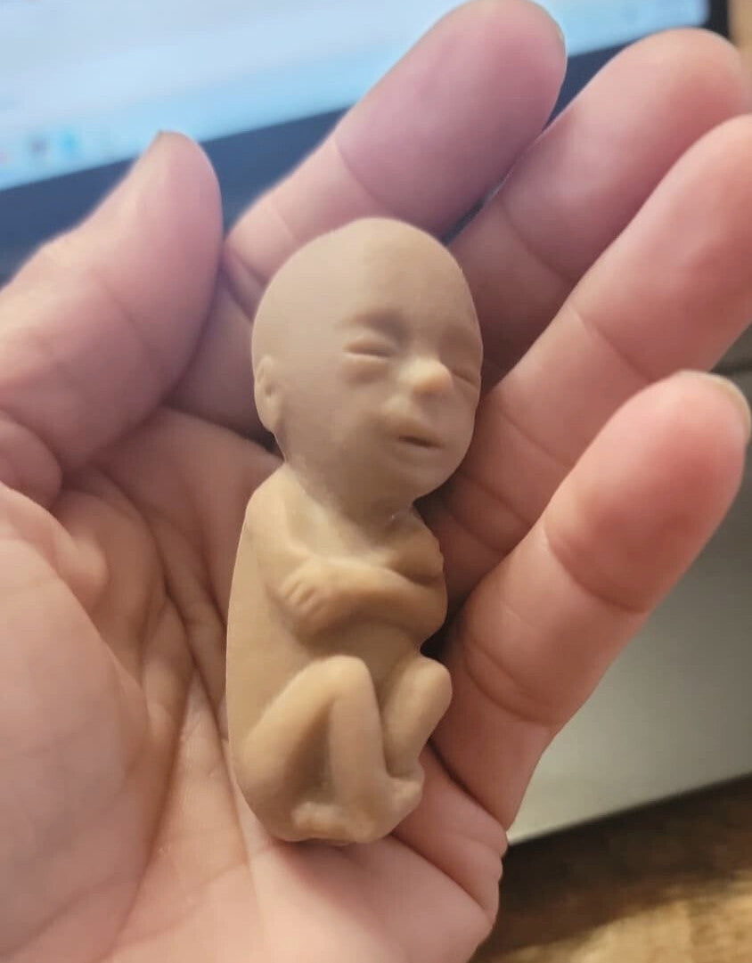 Heritage House '76, 12 Weeks Fetal Model, Precious One, 50 pk Dark Skin Tone